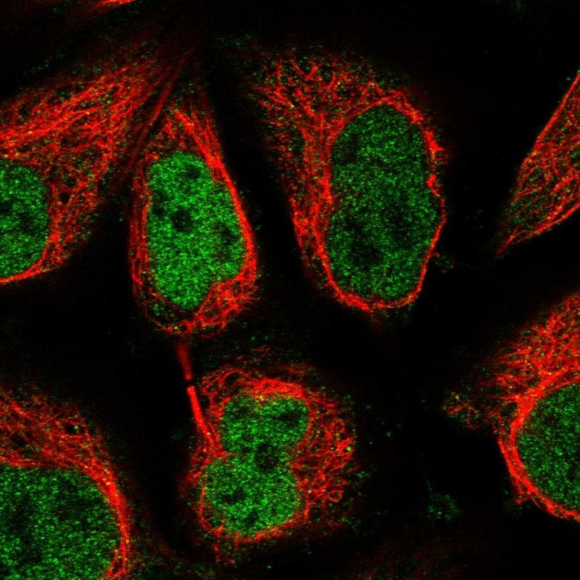 Torc2 Antibody in Immunocytochemistry (ICC/IF)