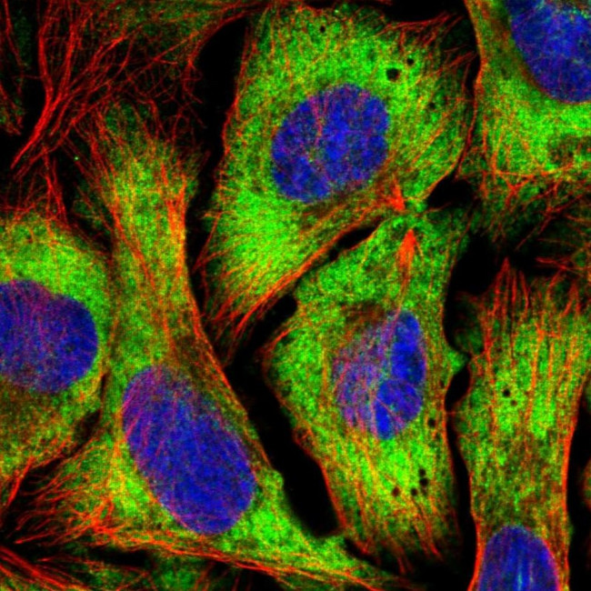eIF4G Antibody in Immunocytochemistry (ICC/IF)