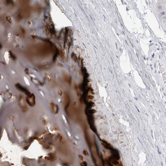 MATN1 Antibody in Immunohistochemistry (Paraffin) (IHC (P))