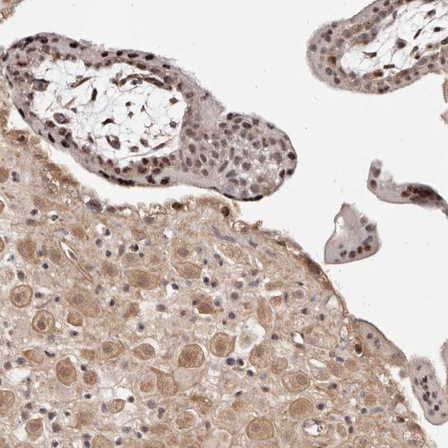 WRN Antibody in Immunohistochemistry (Paraffin) (IHC (P))