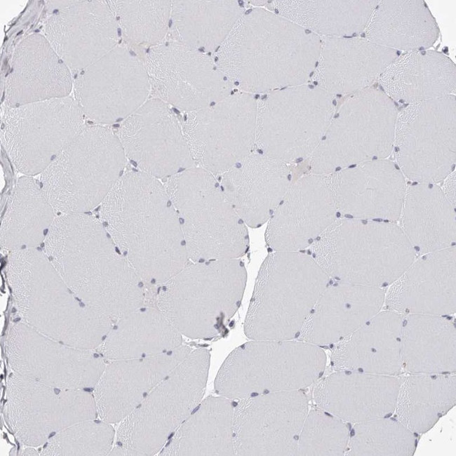 PACSIN1 Antibody in Immunohistochemistry (Paraffin) (IHC (P))