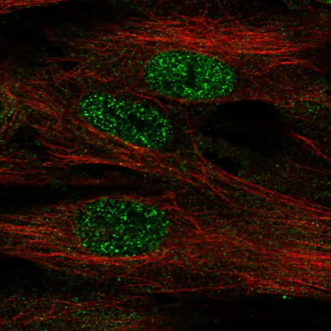 FOXF1 Antibody in Immunocytochemistry (ICC/IF)
