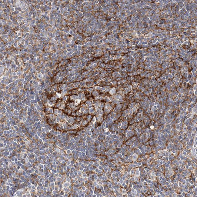 CD82 Antibody in Immunohistochemistry (Paraffin) (IHC (P))