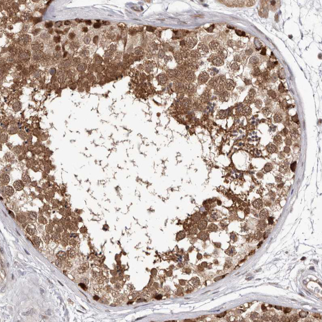 TXNL2 Antibody in Immunohistochemistry (Paraffin) (IHC (P))