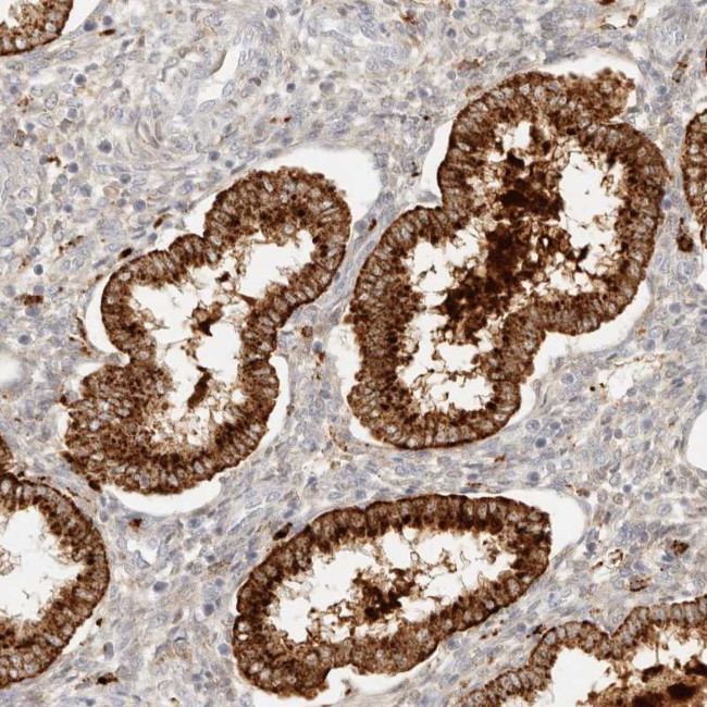 RNASET2 Antibody in Immunohistochemistry (Paraffin) (IHC (P))