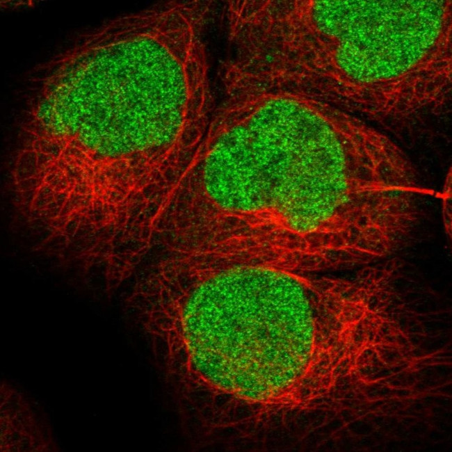 FALZ Antibody in Immunocytochemistry (ICC/IF)