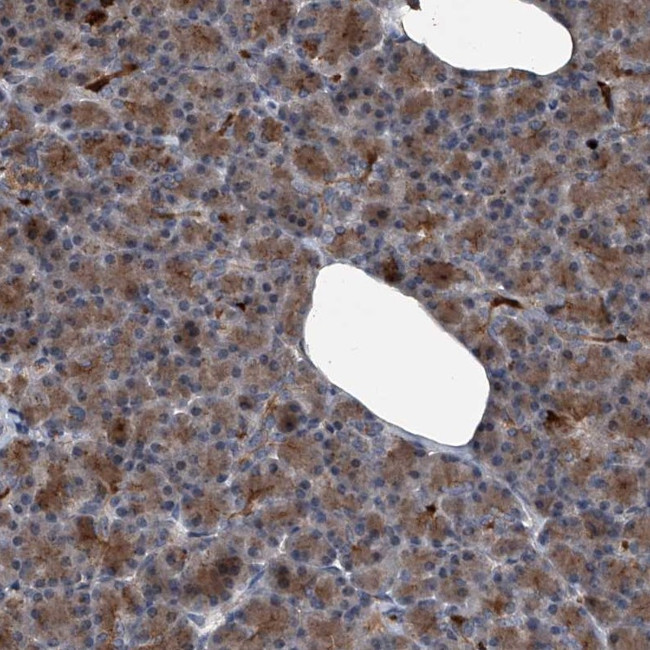 MAPKAP1 Antibody in Immunohistochemistry (Paraffin) (IHC (P))