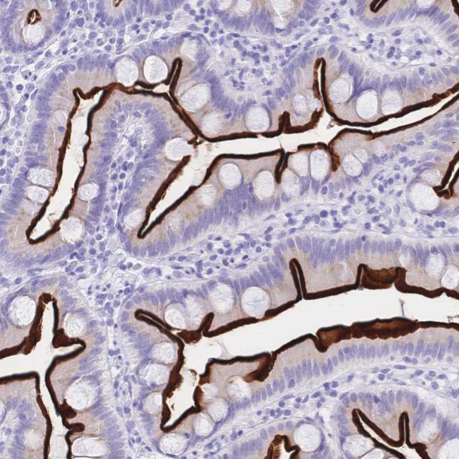 MEP1B Antibody in Immunohistochemistry (Paraffin) (IHC (P))