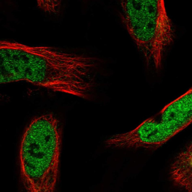 Apolipoprotein L6 Antibody in Immunocytochemistry (ICC/IF)