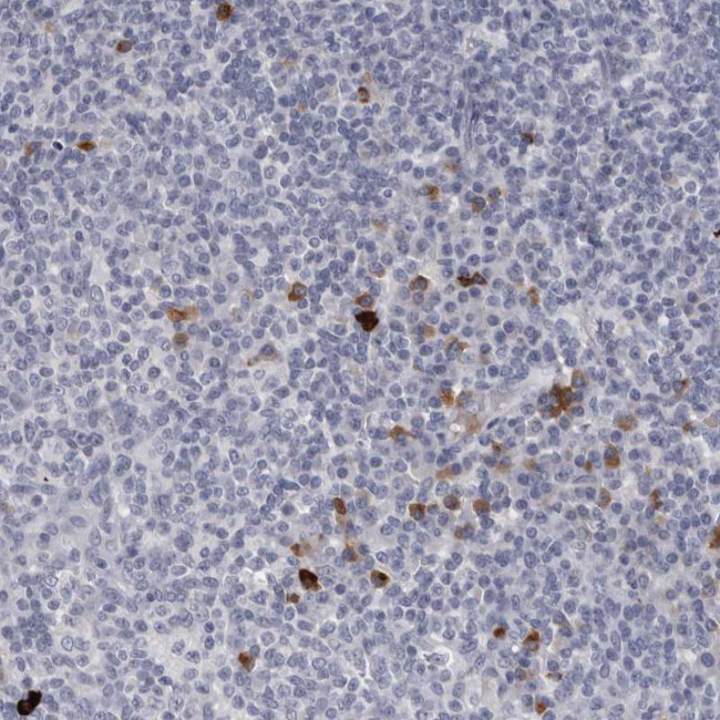 Granzyme H Antibody in Immunohistochemistry (Paraffin) (IHC (P))