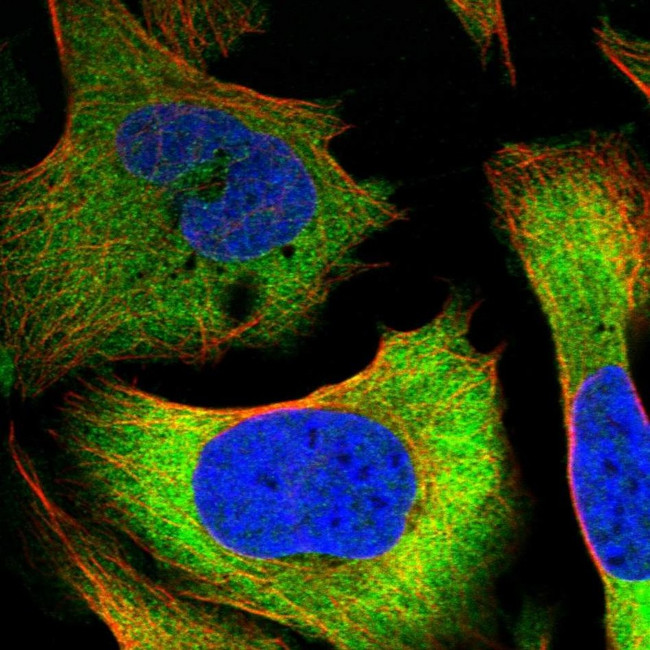 TCP-1 delta Antibody in Immunocytochemistry (ICC/IF)