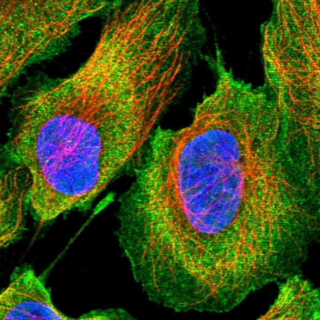 ETNK1 Antibody in Immunocytochemistry (ICC/IF)