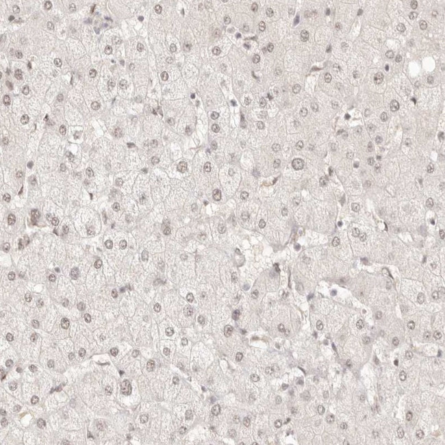 MEP1A Antibody in Immunohistochemistry (Paraffin) (IHC (P))