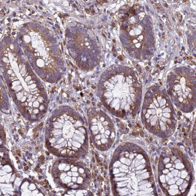RNF215 Antibody in Immunohistochemistry (Paraffin) (IHC (P))