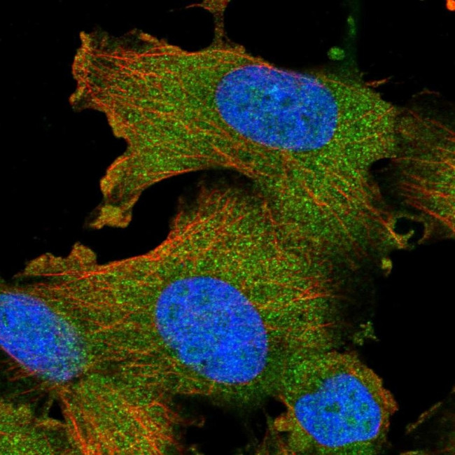 STK16 Antibody in Immunocytochemistry (ICC/IF)