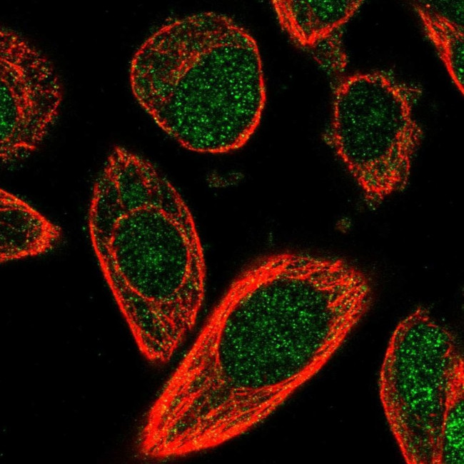 CHML Antibody in Immunocytochemistry (ICC/IF)