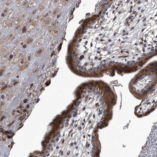 SIRT4 Antibody in Immunohistochemistry (Paraffin) (IHC (P))