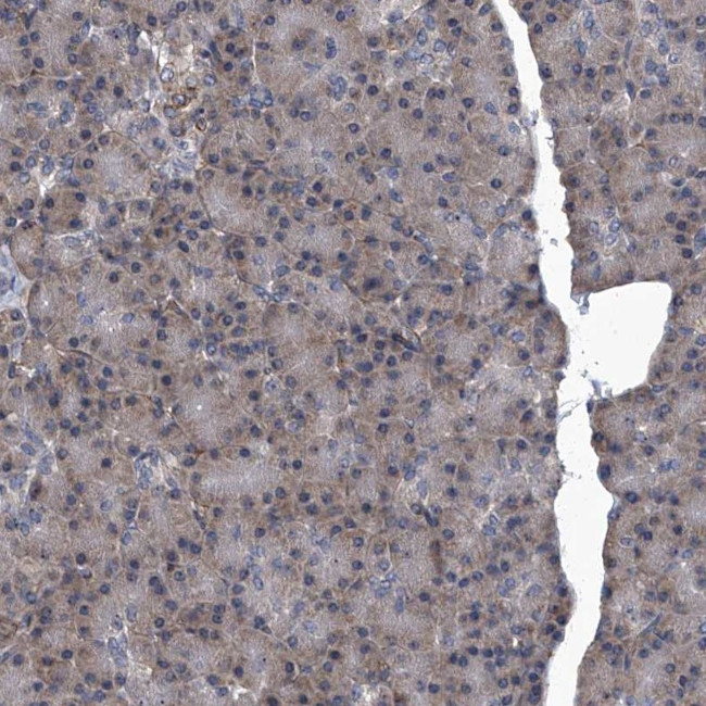 SIRT4 Antibody in Immunohistochemistry (Paraffin) (IHC (P))