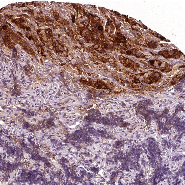 CGA Antibody in Immunohistochemistry (Paraffin) (IHC (P))