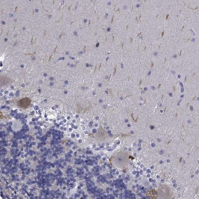 PLXNA4 Antibody in Immunohistochemistry (Paraffin) (IHC (P))