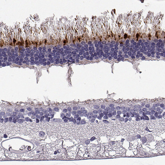 RD3 Antibody in Immunohistochemistry (Paraffin) (IHC (P))
