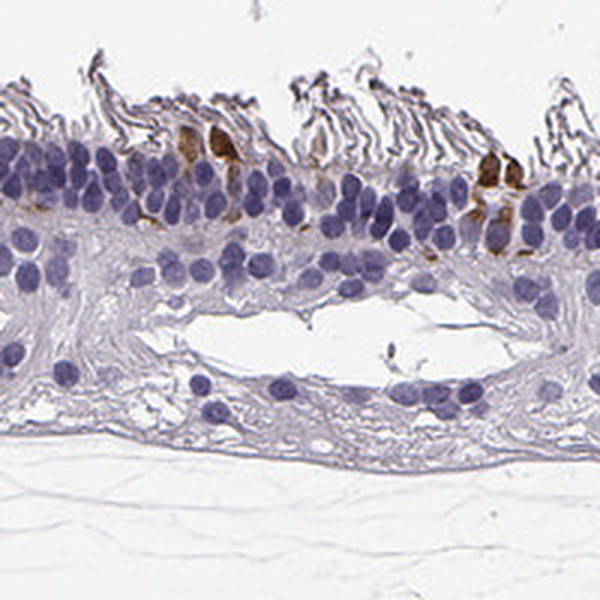 RD3 Antibody in Immunohistochemistry (Paraffin) (IHC (P))
