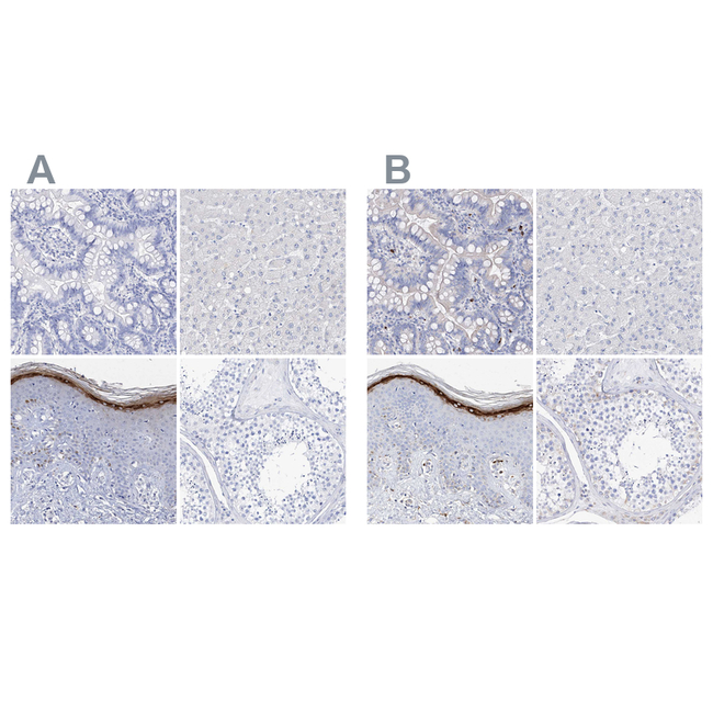 Filaggrin Antibody in Immunohistochemistry (Paraffin) (IHC (P))