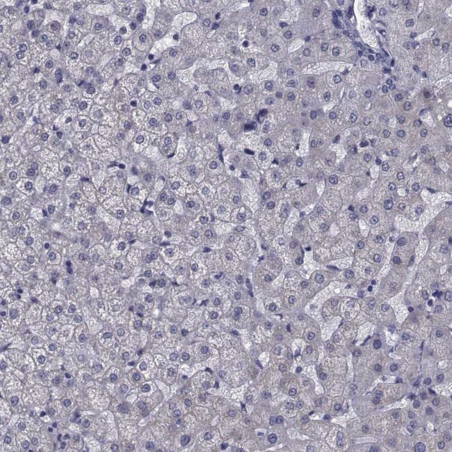 KIAA1751 Antibody in Immunohistochemistry (Paraffin) (IHC (P))
