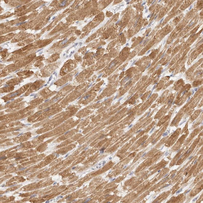 TFB2M Antibody in Immunohistochemistry (Paraffin) (IHC (P))