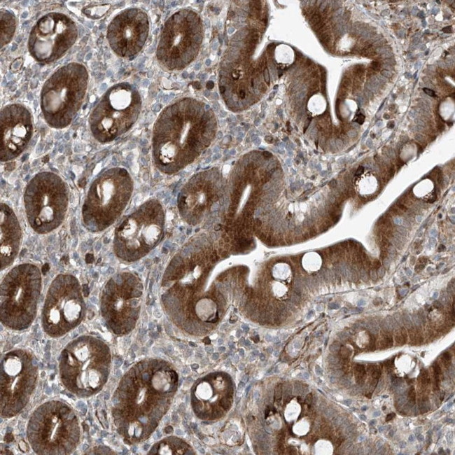 ZNF7 Antibody in Immunohistochemistry (Paraffin) (IHC (P))