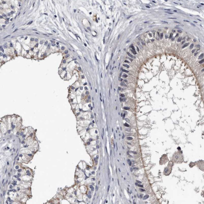 Prostasin Antibody in Immunohistochemistry (Paraffin) (IHC (P))