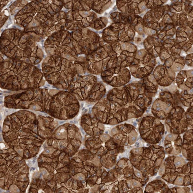 Galectin 8 Antibody in Immunohistochemistry (Paraffin) (IHC (P))