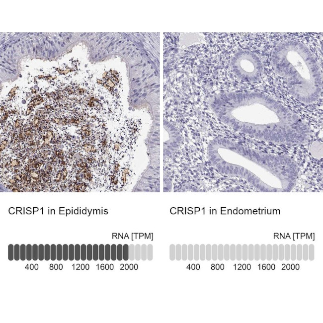 CRISP1 Antibody
