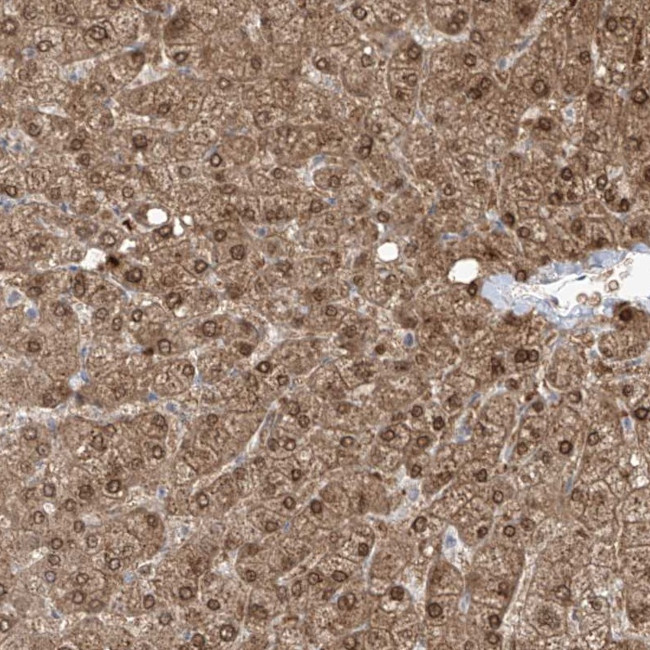 OGT Antibody in Immunohistochemistry (Paraffin) (IHC (P))