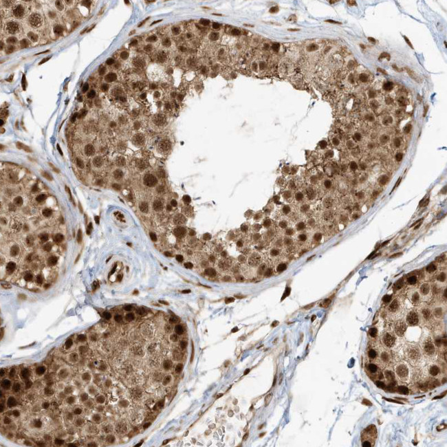 CKS2 Antibody in Immunohistochemistry (Paraffin) (IHC (P))