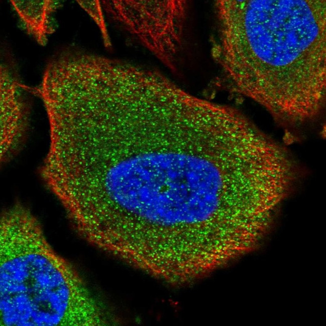 GPBB Antibody in Immunocytochemistry (ICC/IF)