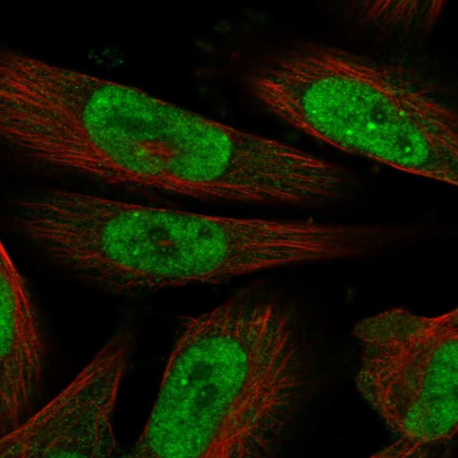 MLLT1 Antibody in Immunocytochemistry (ICC/IF)