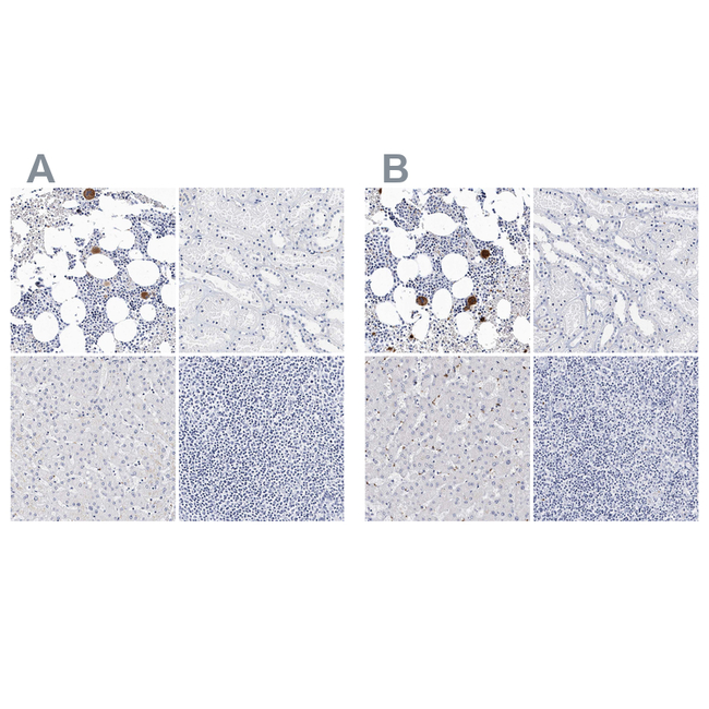 CD41 Antibody in Immunohistochemistry (Paraffin) (IHC (P))