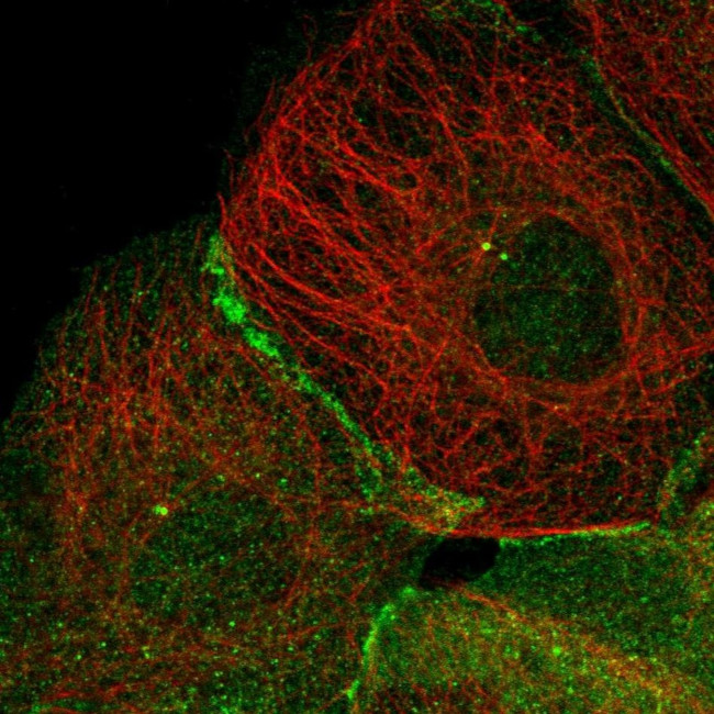 TRIM38 Antibody in Immunocytochemistry (ICC/IF)