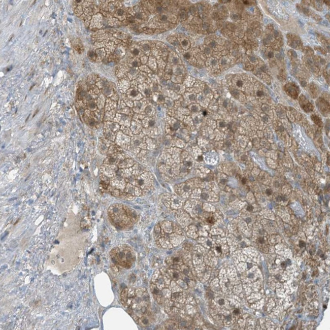 PARVG Antibody in Immunohistochemistry (Paraffin) (IHC (P))