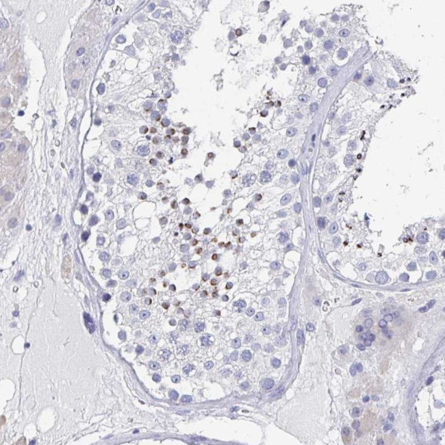 CD30 Antibody in Immunohistochemistry (Paraffin) (IHC (P))