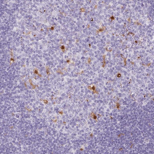 CD30 Antibody in Immunohistochemistry (Paraffin) (IHC (P))