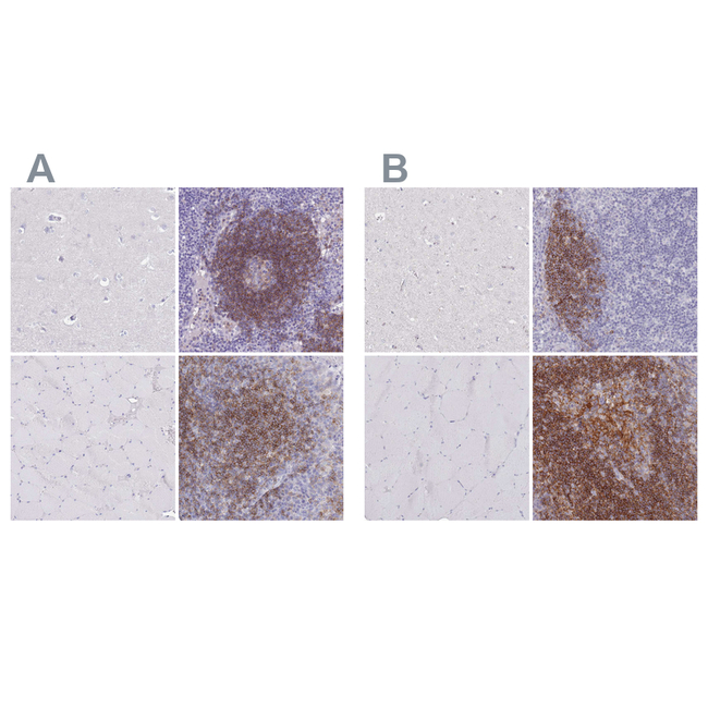 CD37 Antibody in Immunohistochemistry (Paraffin) (IHC (P))