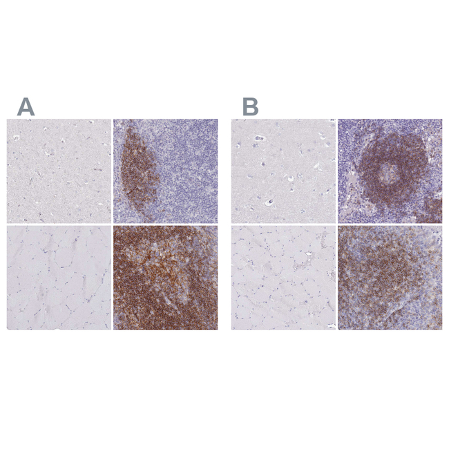 CD37 Antibody in Immunohistochemistry (Paraffin) (IHC (P))