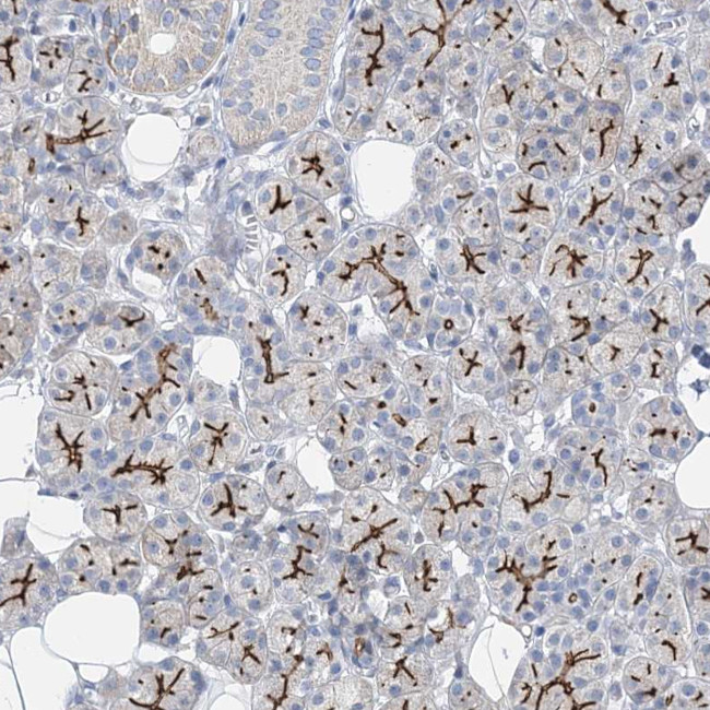 DOG-1 Antibody in Immunohistochemistry (Paraffin) (IHC (P))