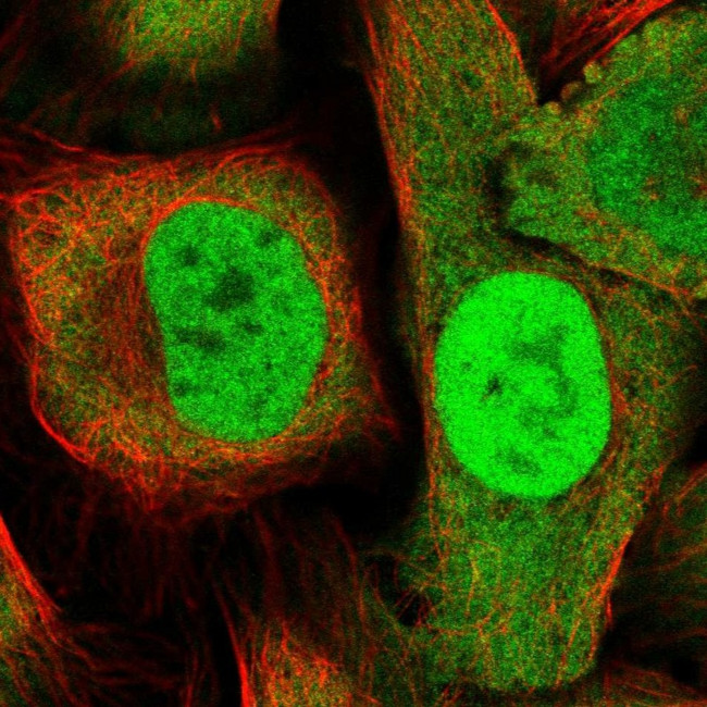 DDX1 Antibody in Immunocytochemistry (ICC/IF)