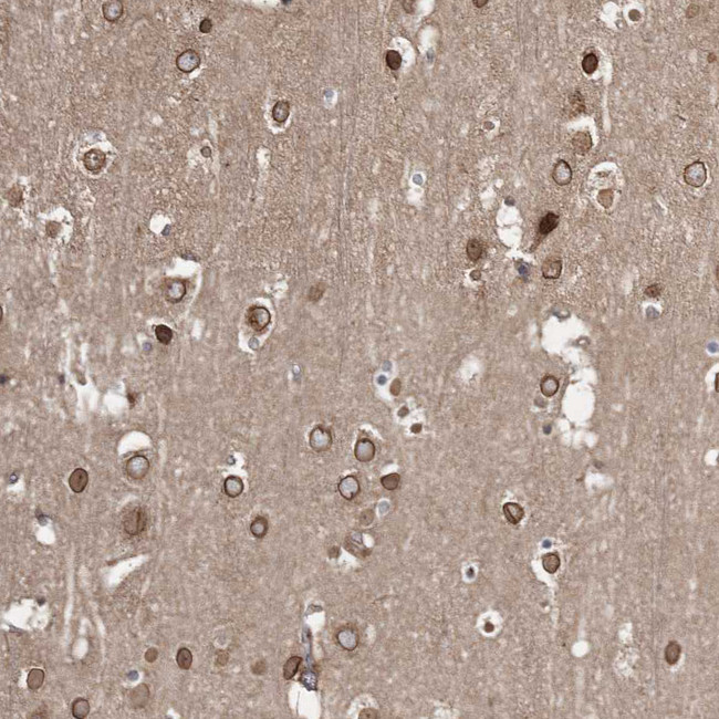 PRC1 Antibody in Immunohistochemistry (Paraffin) (IHC (P))