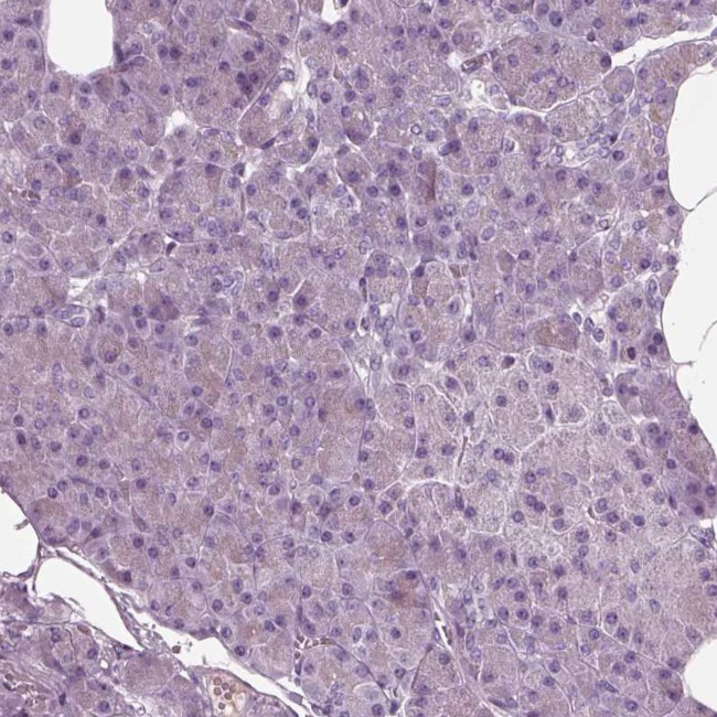 CRMP5 Antibody in Immunohistochemistry (Paraffin) (IHC (P))