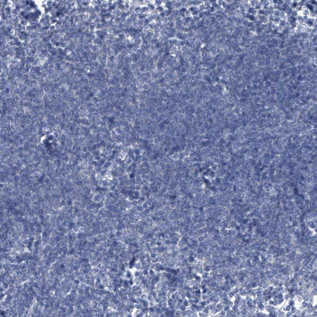 FABP2 Antibody in Immunohistochemistry (Paraffin) (IHC (P))