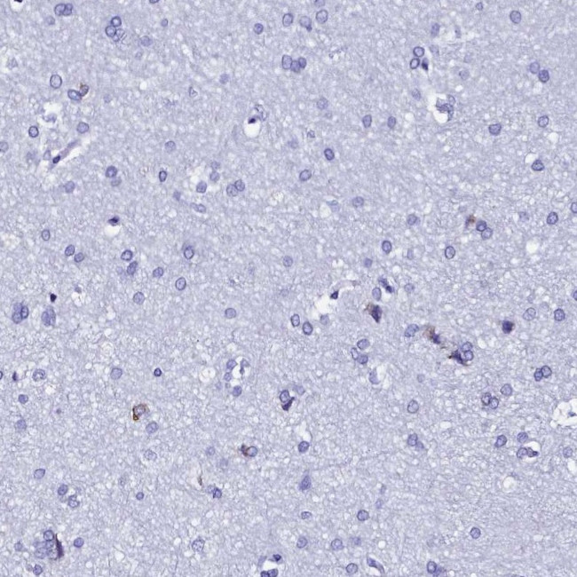 TXNDC5 Antibody in Immunohistochemistry (Paraffin) (IHC (P))